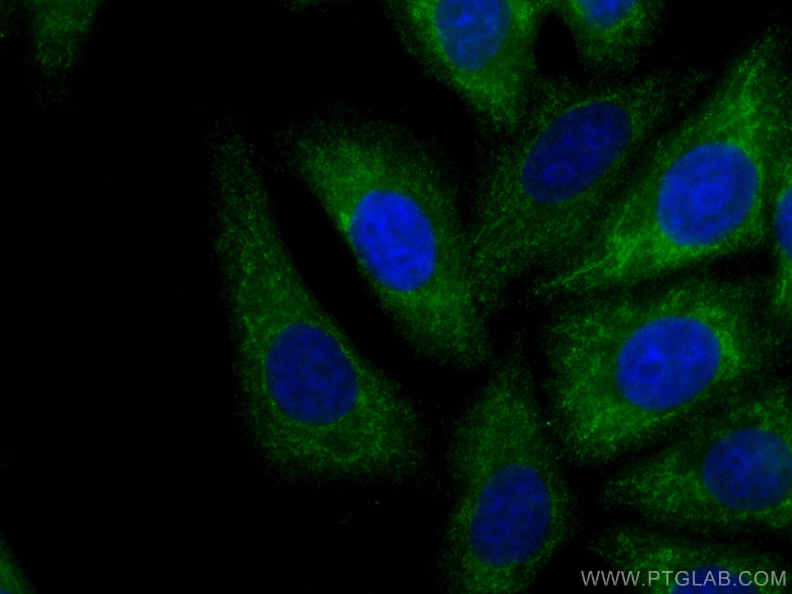 Immunofluorescence (IF) / fluorescent staining of HepG2 cells using GNB3 Monoclonal antibody (67497-1-Ig)