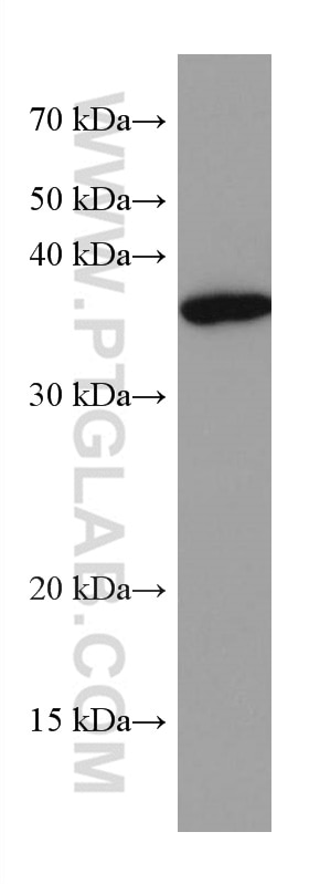 WB analysis of L02 using 67497-1-Ig