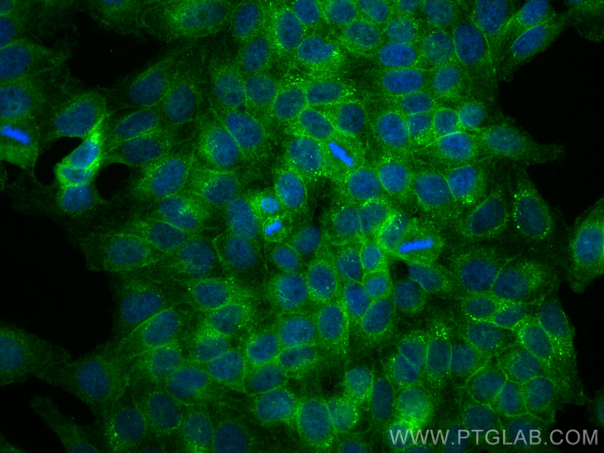 Immunofluorescence (IF) / fluorescent staining of HepG2 cells using GNB4 Polyclonal antibody (11978-2-AP)