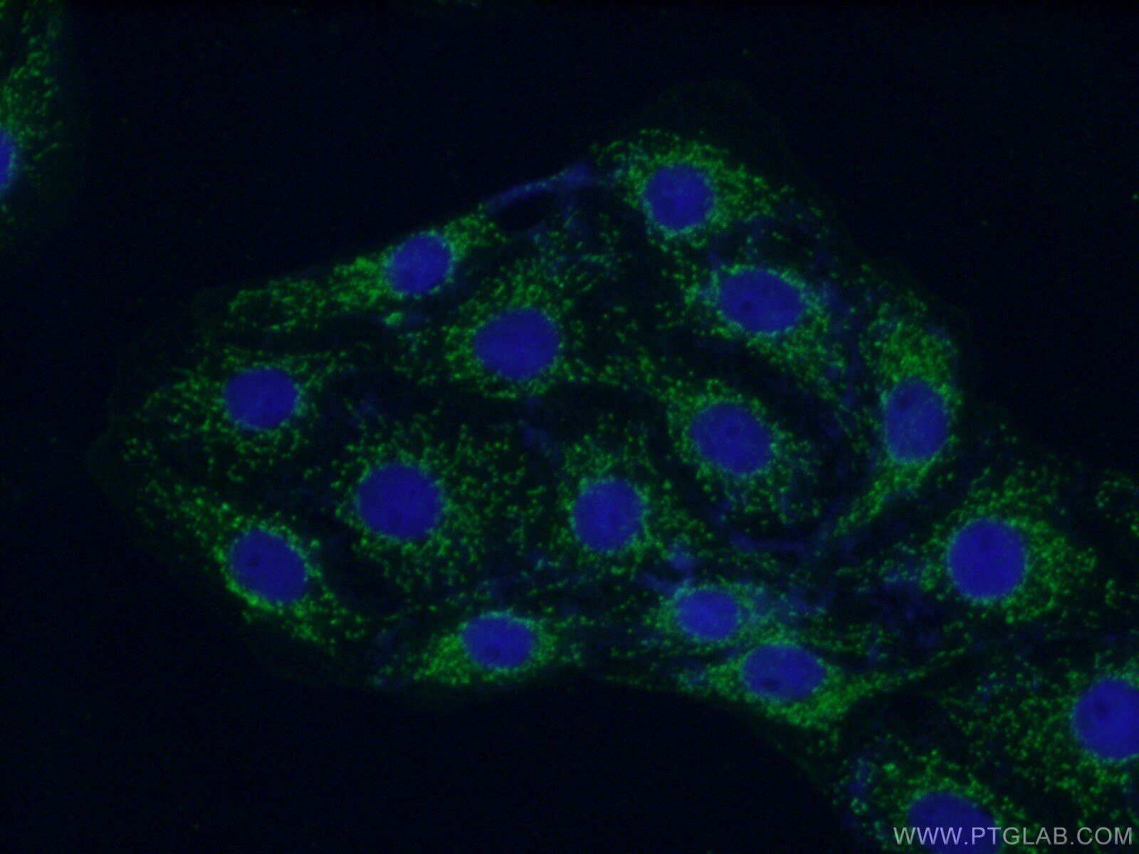 Immunofluorescence (IF) / fluorescent staining of SH-SY5Y cells using GNB4 Polyclonal antibody (11978-2-AP)