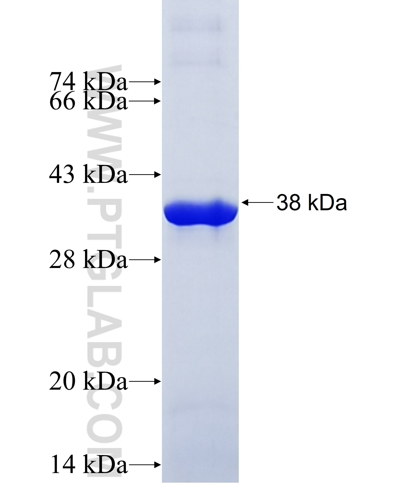 GNB4 fusion protein Ag32664 SDS-PAGE GNB4 fusion protein Ag32664 SDS-PAGE