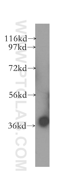 Western Blot (WB) analysis of human brain tissue using GNB5 Polyclonal antibody (11045-2-AP)