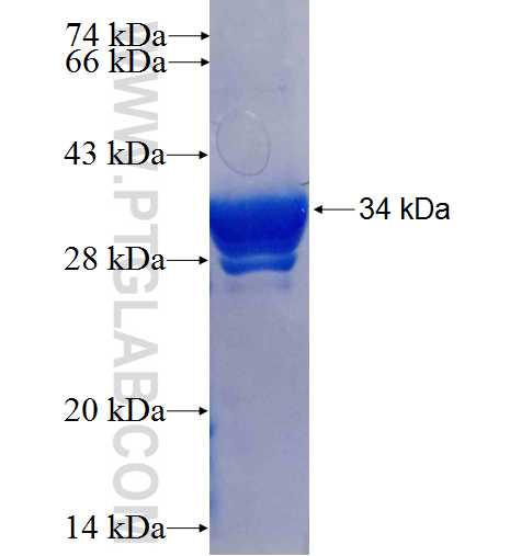 GNB5 fusion protein Ag1518 SDS-PAGE