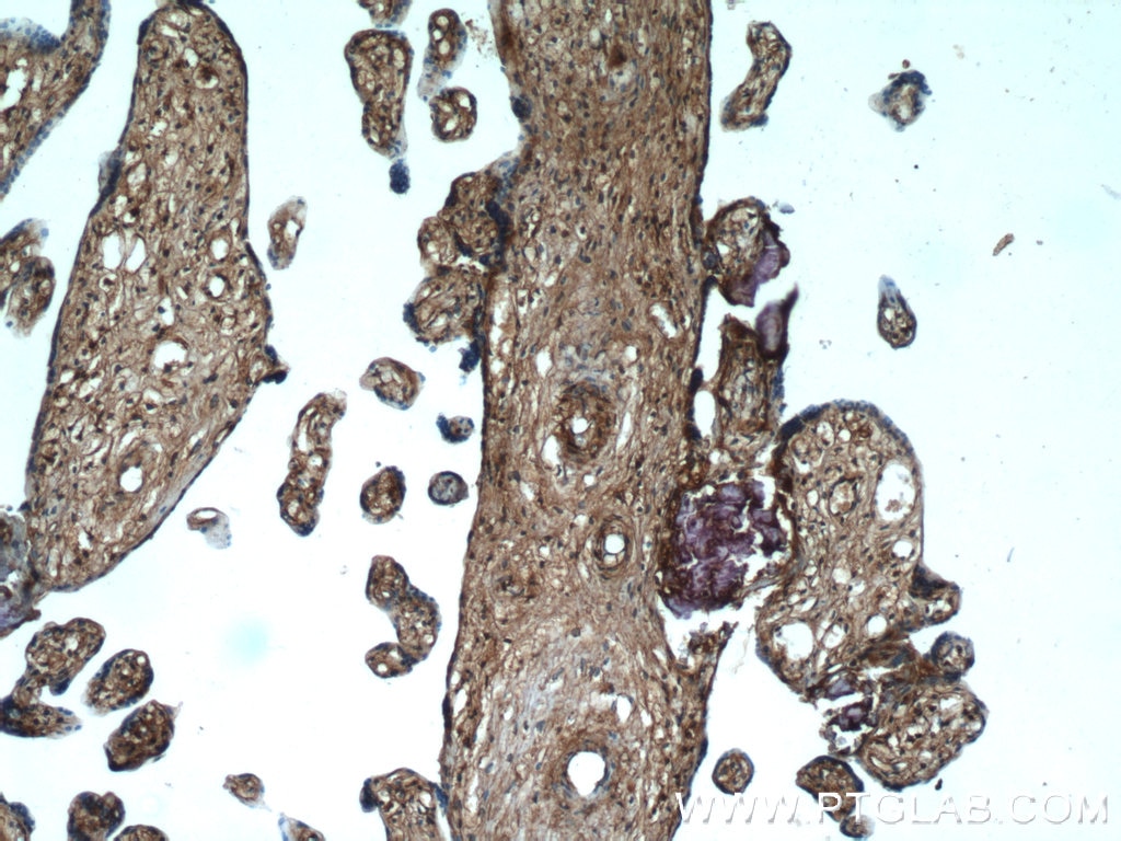 Immunohistochemistry (IHC) staining of human placenta tissue using GNE Polyclonal antibody (25079-1-AP)