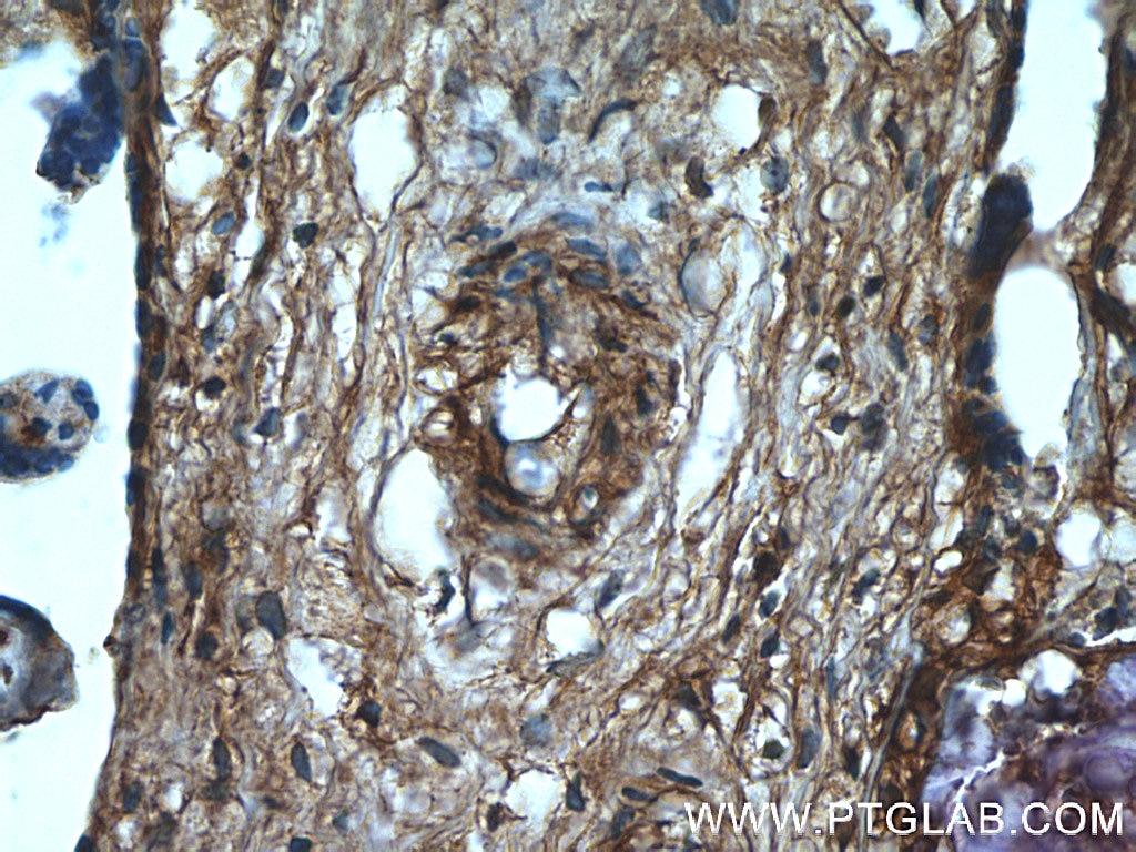 Immunohistochemistry (IHC) staining of human placenta tissue using GNE Polyclonal antibody (25079-1-AP)