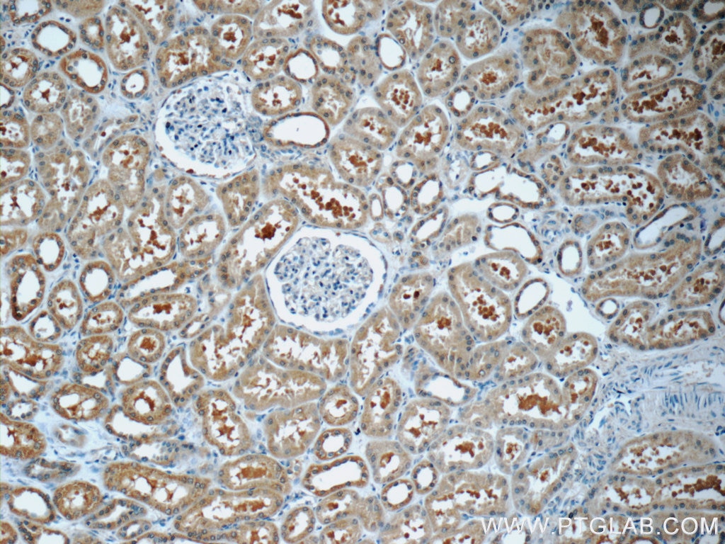 Immunohistochemistry (IHC) staining of human kidney tissue using GNE Polyclonal antibody (25079-1-AP)