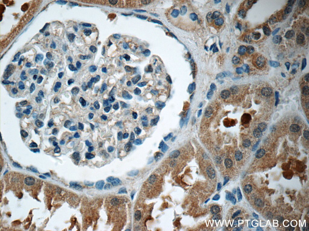 IHC staining of human kidney using 25079-1-AP