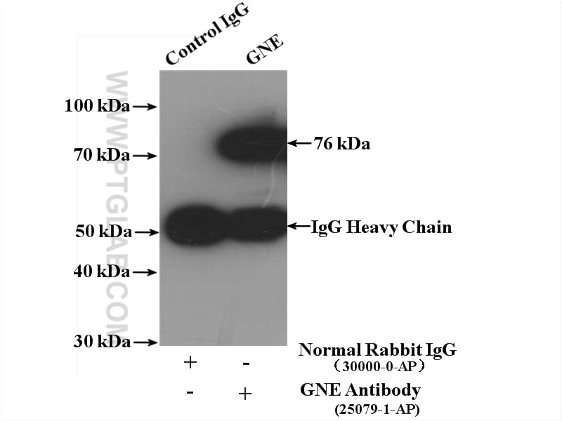 Immunoprecipitation (IP) experiment of Jurkat cells using GNE Polyclonal antibody (25079-1-AP)