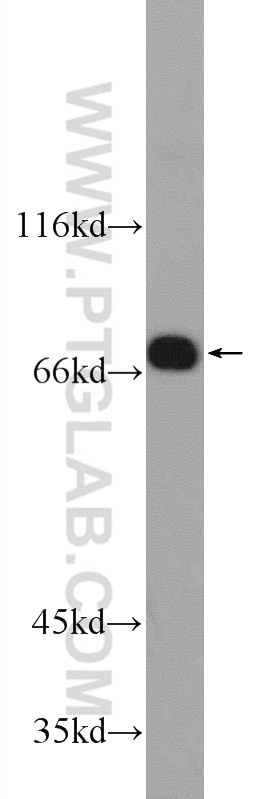 Western Blot (WB) analysis of Jurkat cells using GNE Polyclonal antibody (25079-1-AP)