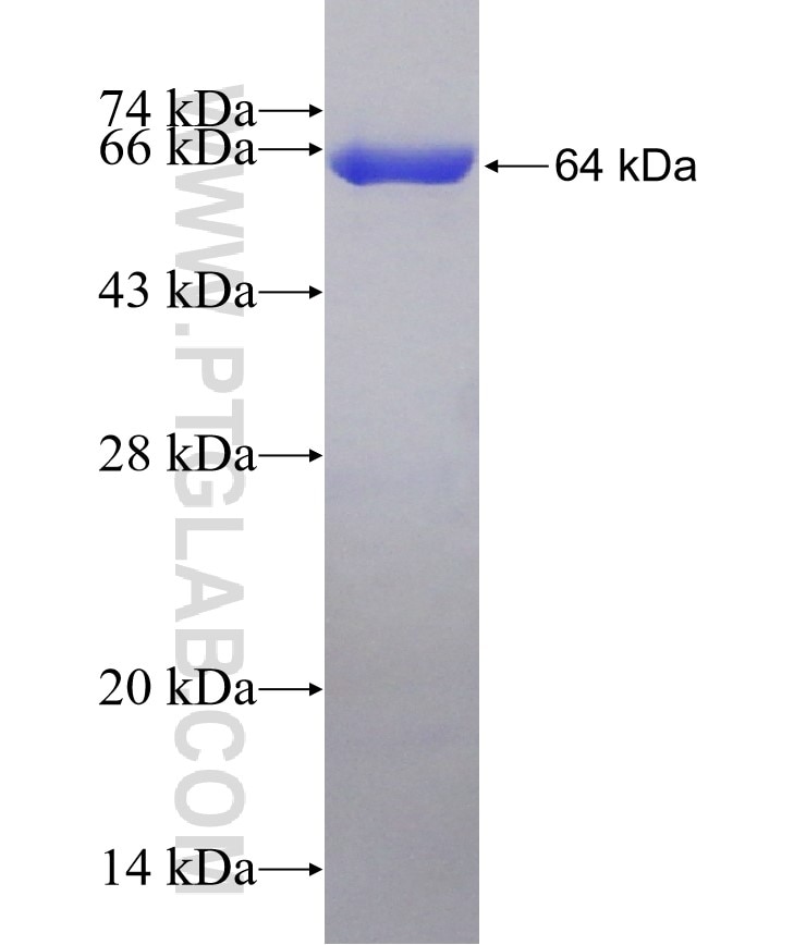 GNE fusion protein Ag18689 SDS-PAGE