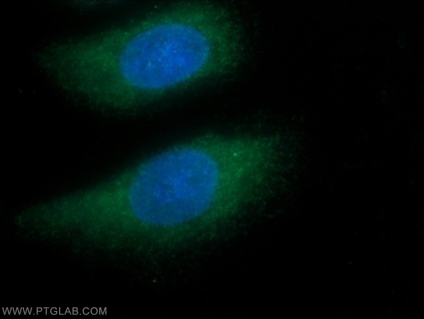 Immunofluorescence (IF) / fluorescent staining of HeLa cells using GNGT1 Polyclonal antibody (11884-1-AP)