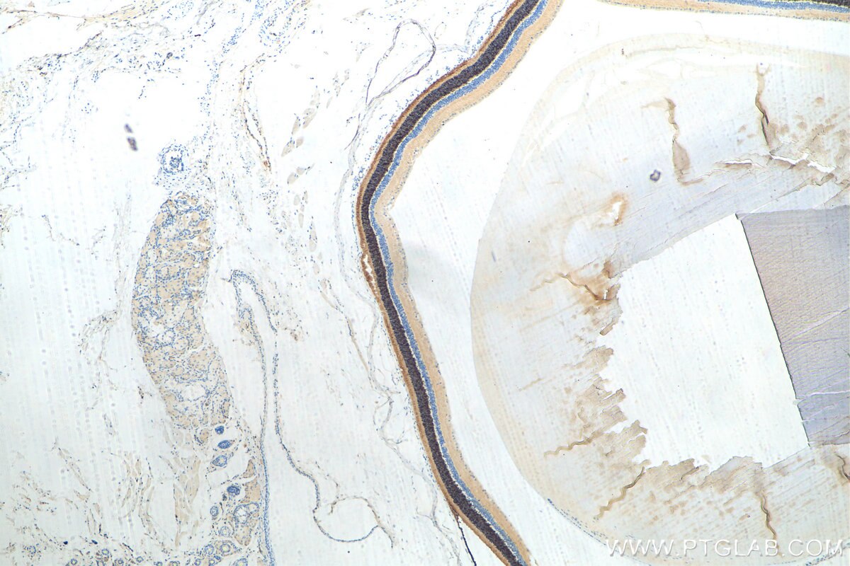 Immunohistochemistry (IHC) staining of mouse eye tissue using GNGT2 Polyclonal antibody (11988-1-AP)