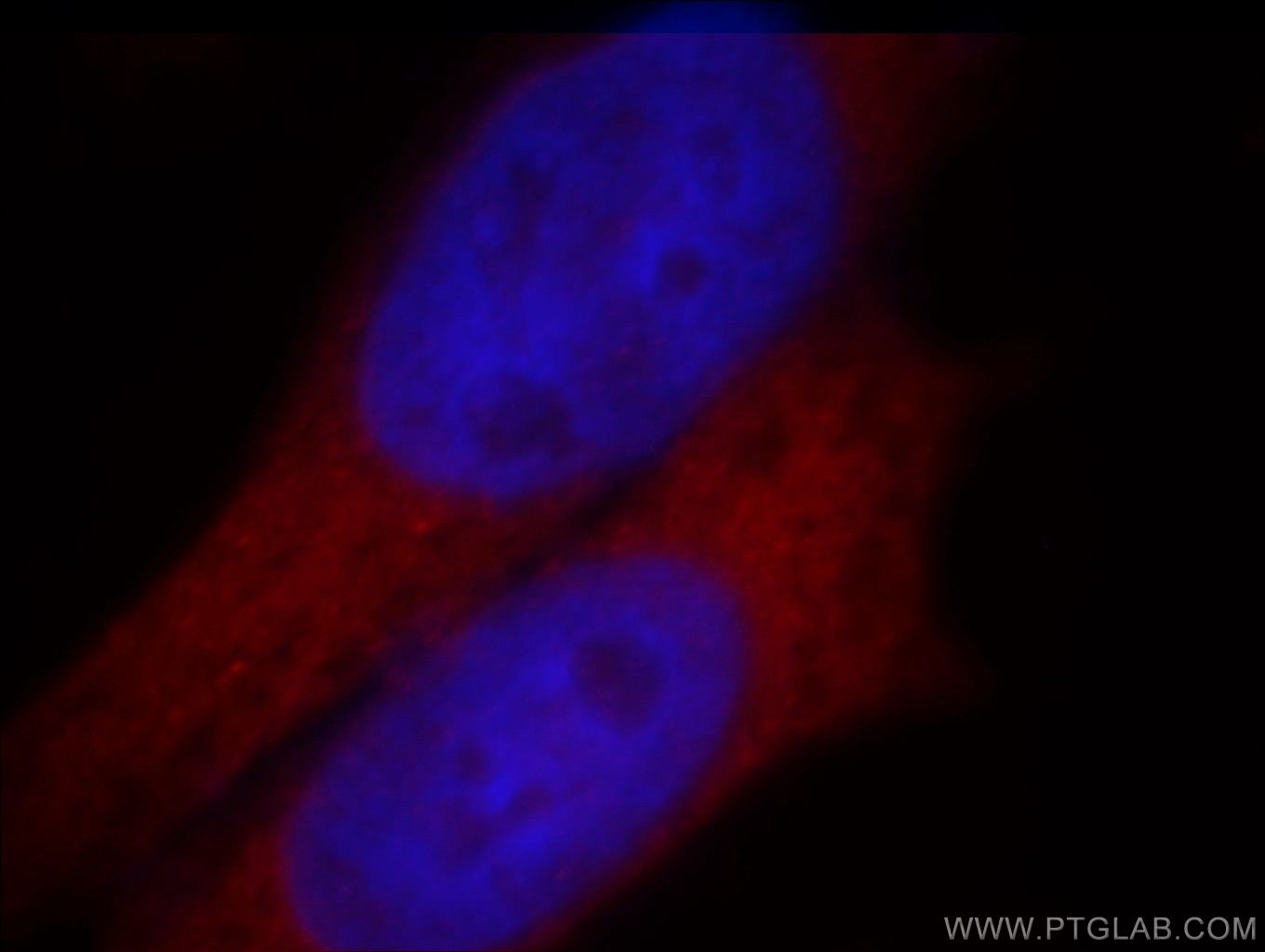 Immunofluorescence (IF) / fluorescent staining of MCF-7 cells using GNL1 Polyclonal antibody (14078-1-AP)