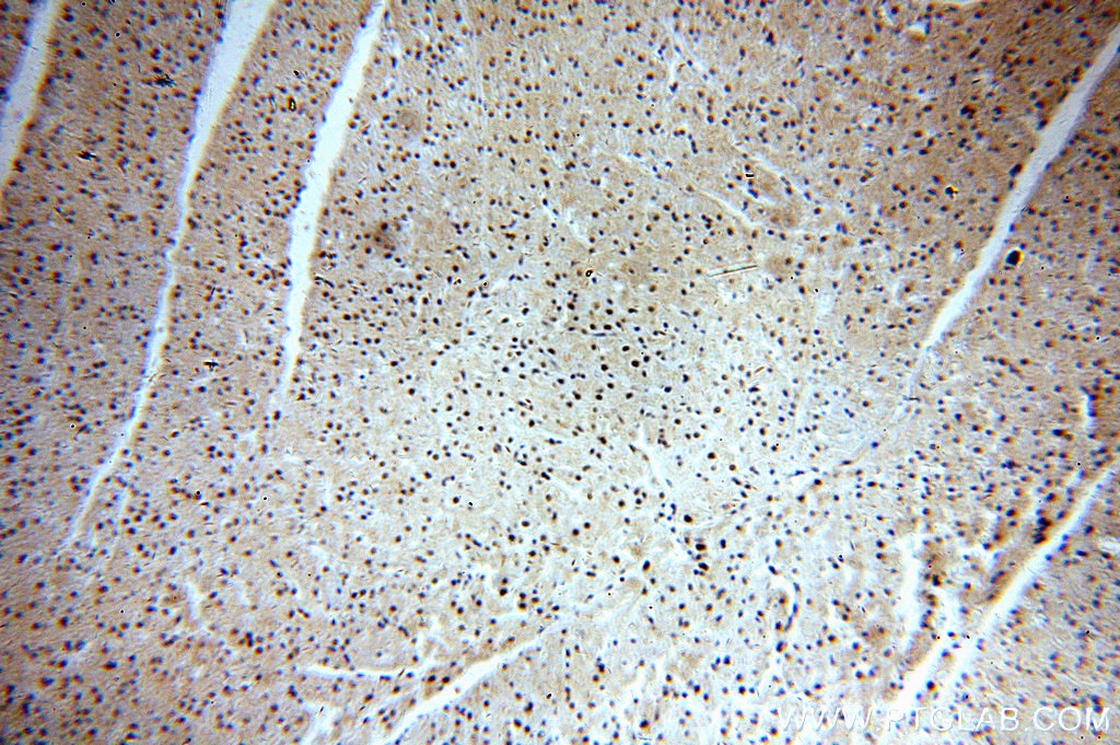 Immunohistochemistry (IHC) staining of human heart tissue using GNL1 Polyclonal antibody (14078-1-AP)