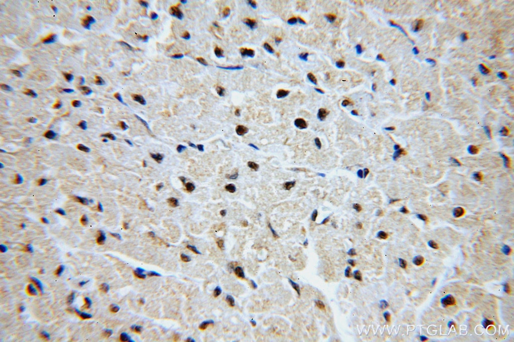 IHC staining of human heart using 14078-1-AP