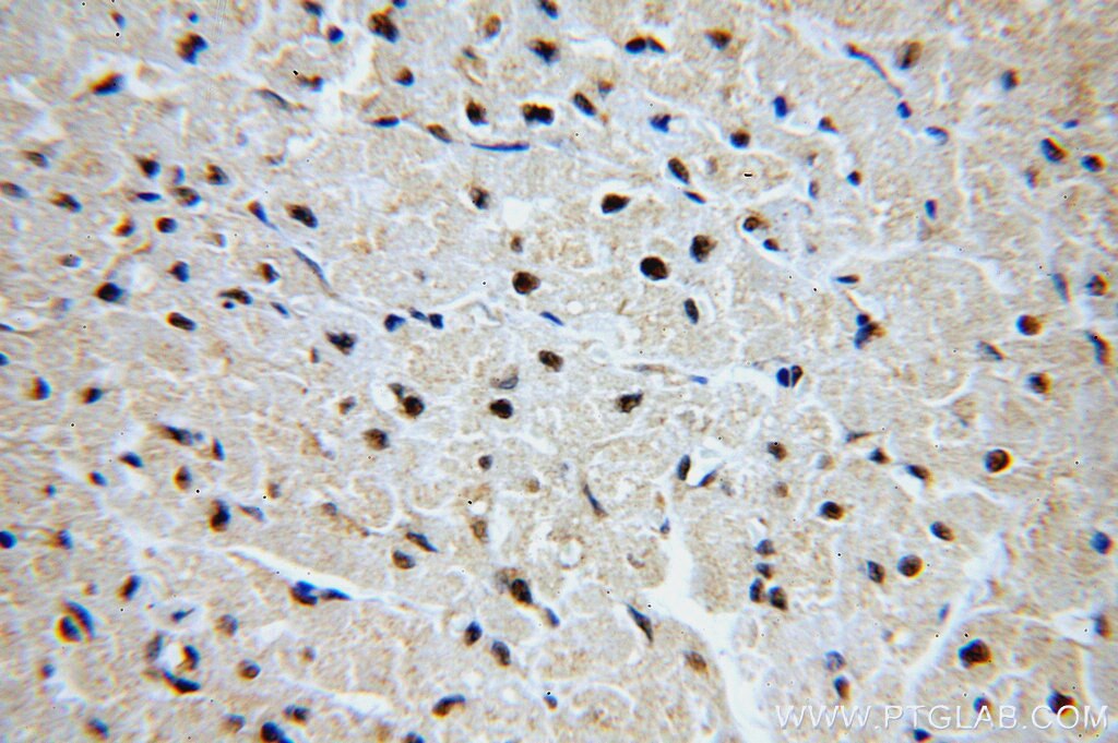 Immunohistochemistry (IHC) staining of human heart tissue using GNL1 Polyclonal antibody (14078-1-AP)