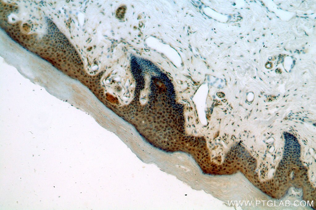 Immunohistochemistry (IHC) staining of human skin tissue using GNL1 Polyclonal antibody (14078-1-AP)