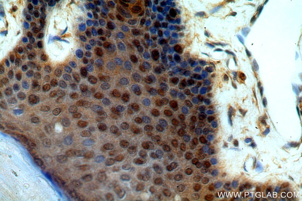 Immunohistochemistry (IHC) staining of human skin tissue using GNL1 Polyclonal antibody (14078-1-AP)