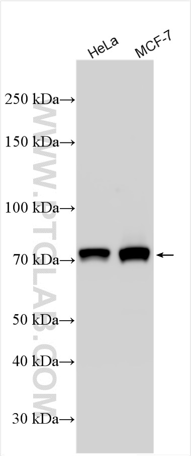 Western Blot (WB) analysis of various lysates using GNL1 Polyclonal antibody (14078-1-AP)