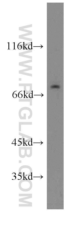 Western Blot (WB) analysis of Jurkat cells using GNL1 Polyclonal antibody (14078-1-AP)