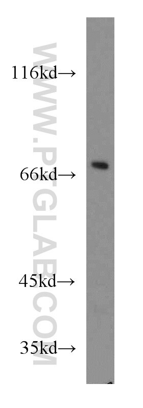 Western Blot (WB) analysis of Raji cells using GNL1 Polyclonal antibody (14078-1-AP)