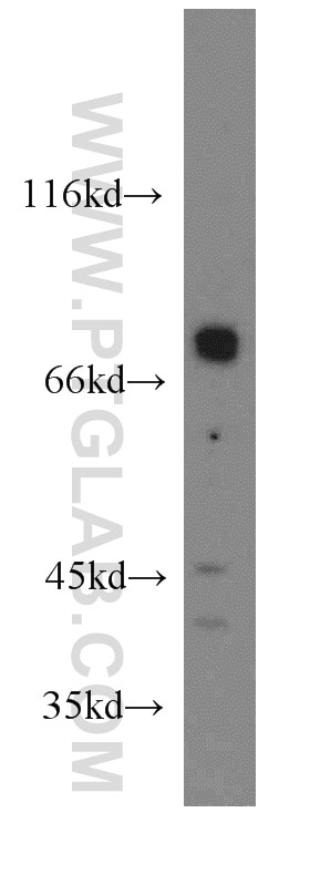 Western Blot (WB) analysis of K-562 cells using GNL1 Polyclonal antibody (14078-1-AP)