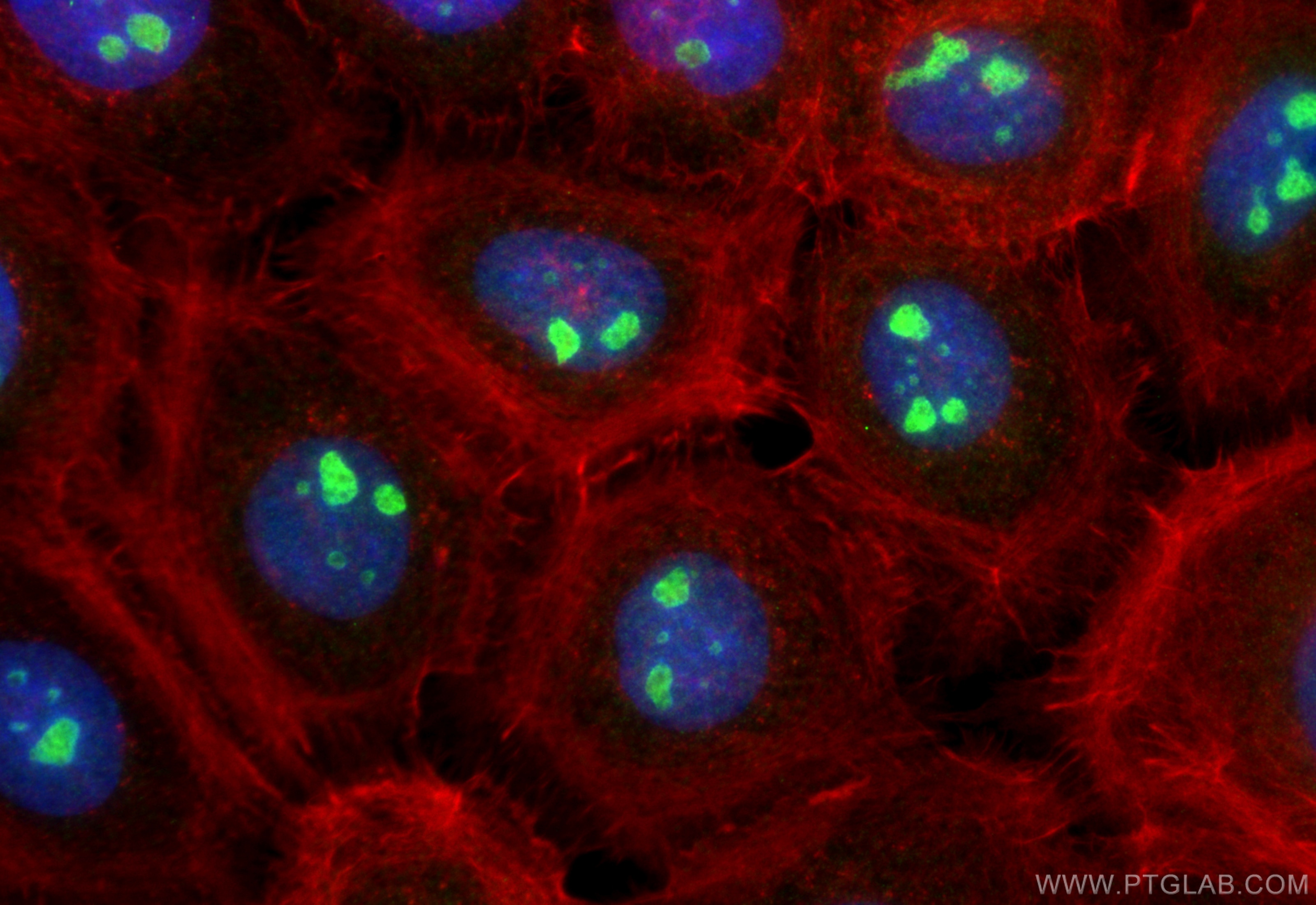 Immunofluorescence (IF) / fluorescent staining of A431 cells using GNL2 Polyclonal antibody (10190-2-AP)