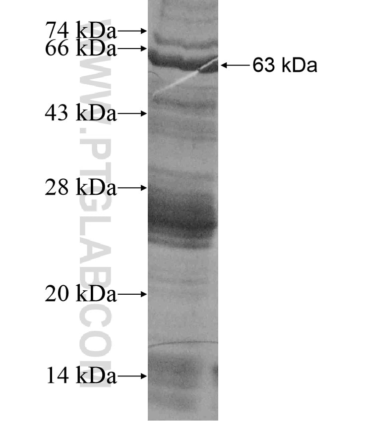 GNL2 fusion protein Ag17757 SDS-PAGE