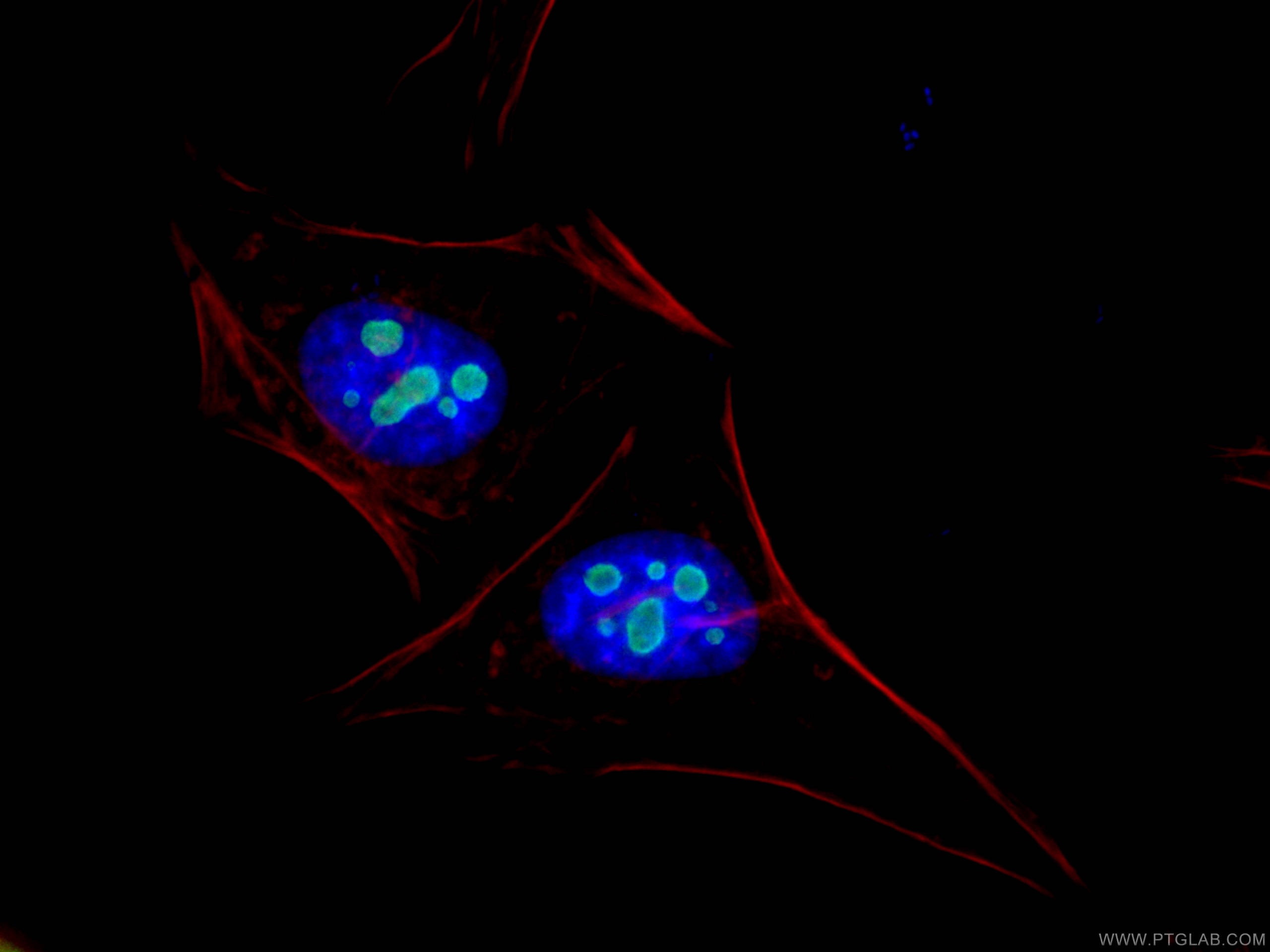 IF Staining of HeLa using 15060-1-AP