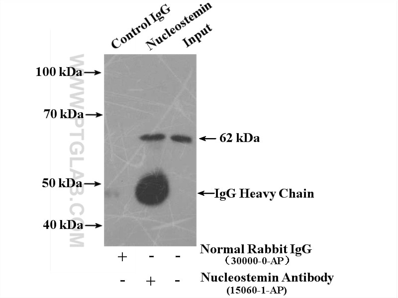 Immunoprecipitation (IP) experiment of HeLa cells using GNL3 Polyclonal antibody (15060-1-AP)