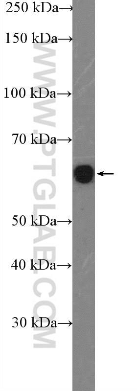 Western Blot (WB) analysis of HeLa cells using GNL3 Polyclonal antibody (15060-1-AP)