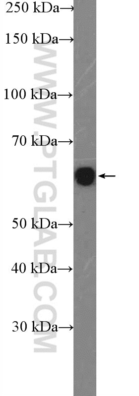 WB analysis of HeLa using 15060-1-AP