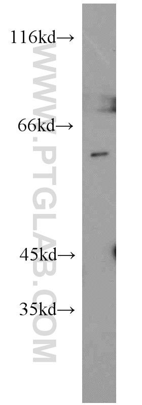 Western Blot (WB) analysis of K-562 cells using GNL3 Polyclonal antibody (15060-1-AP)