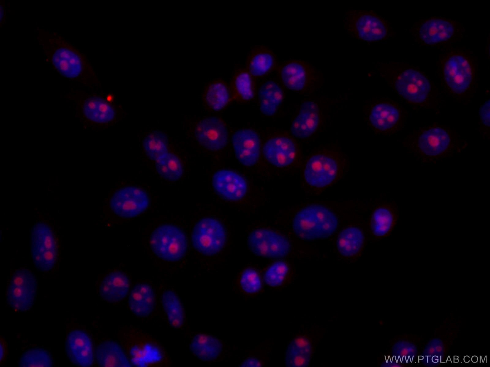 Immunofluorescence (IF) / fluorescent staining of HeLa cells using GNL3 Monoclonal antibody (67169-1-Ig)