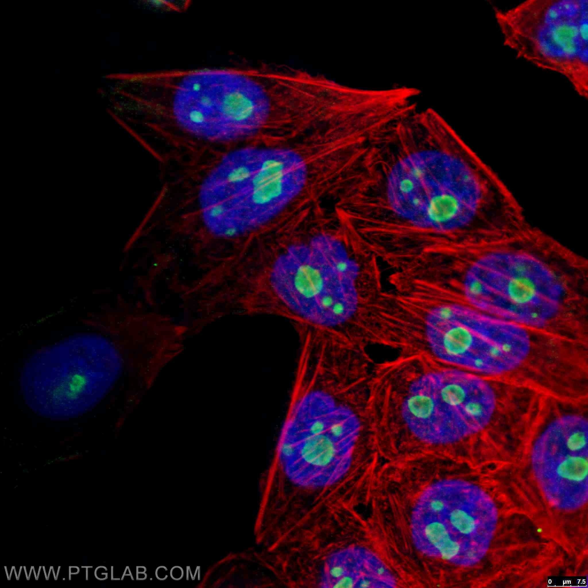 Immunofluorescence (IF) / fluorescent staining of HeLa cells using GNL3 Monoclonal antibody (67169-1-Ig)