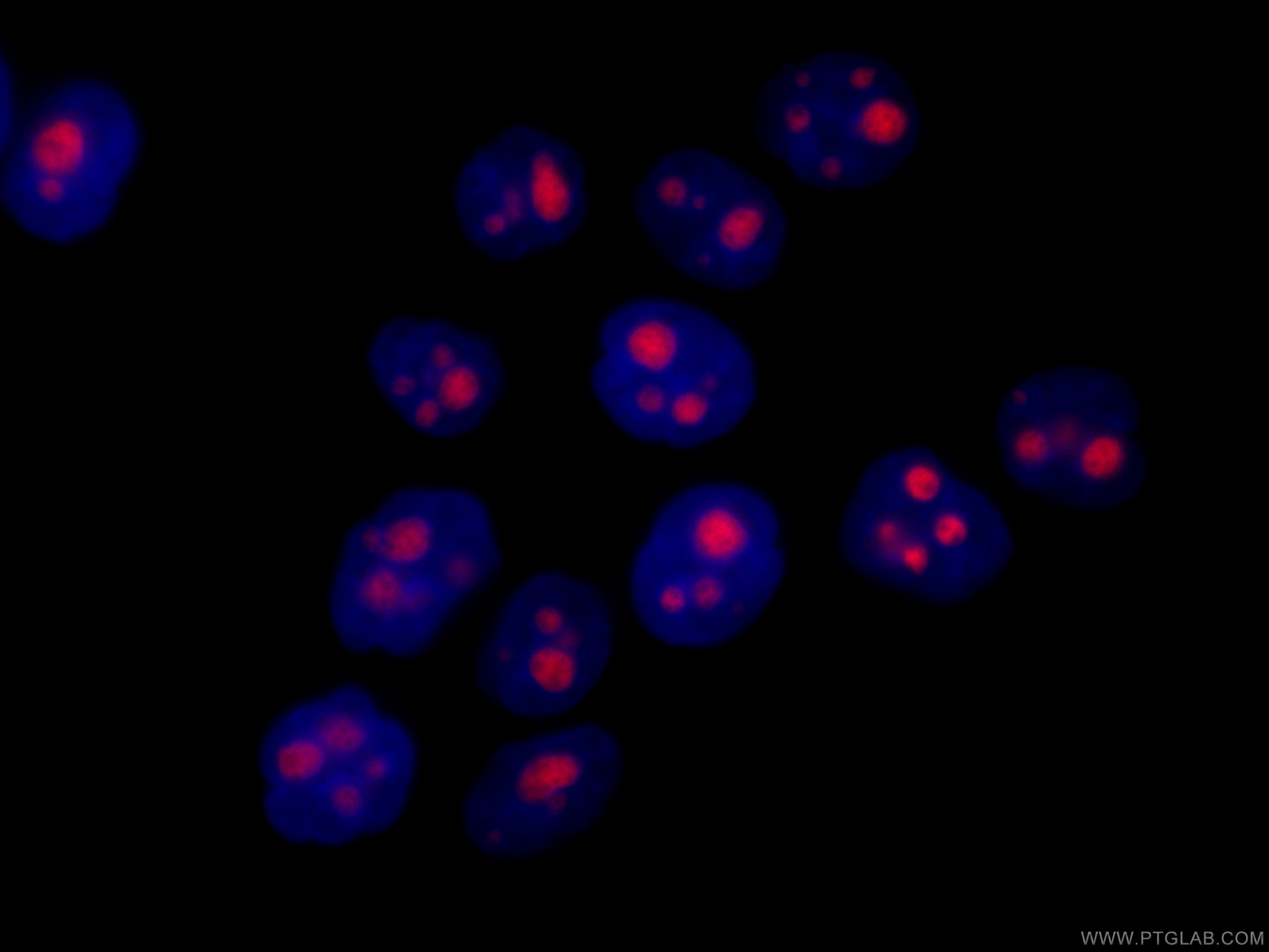 Immunofluorescence (IF) / fluorescent staining of HeLa cells using CoraLite®594-conjugated GNL3 Monoclonal antibody (CL594-67169)
