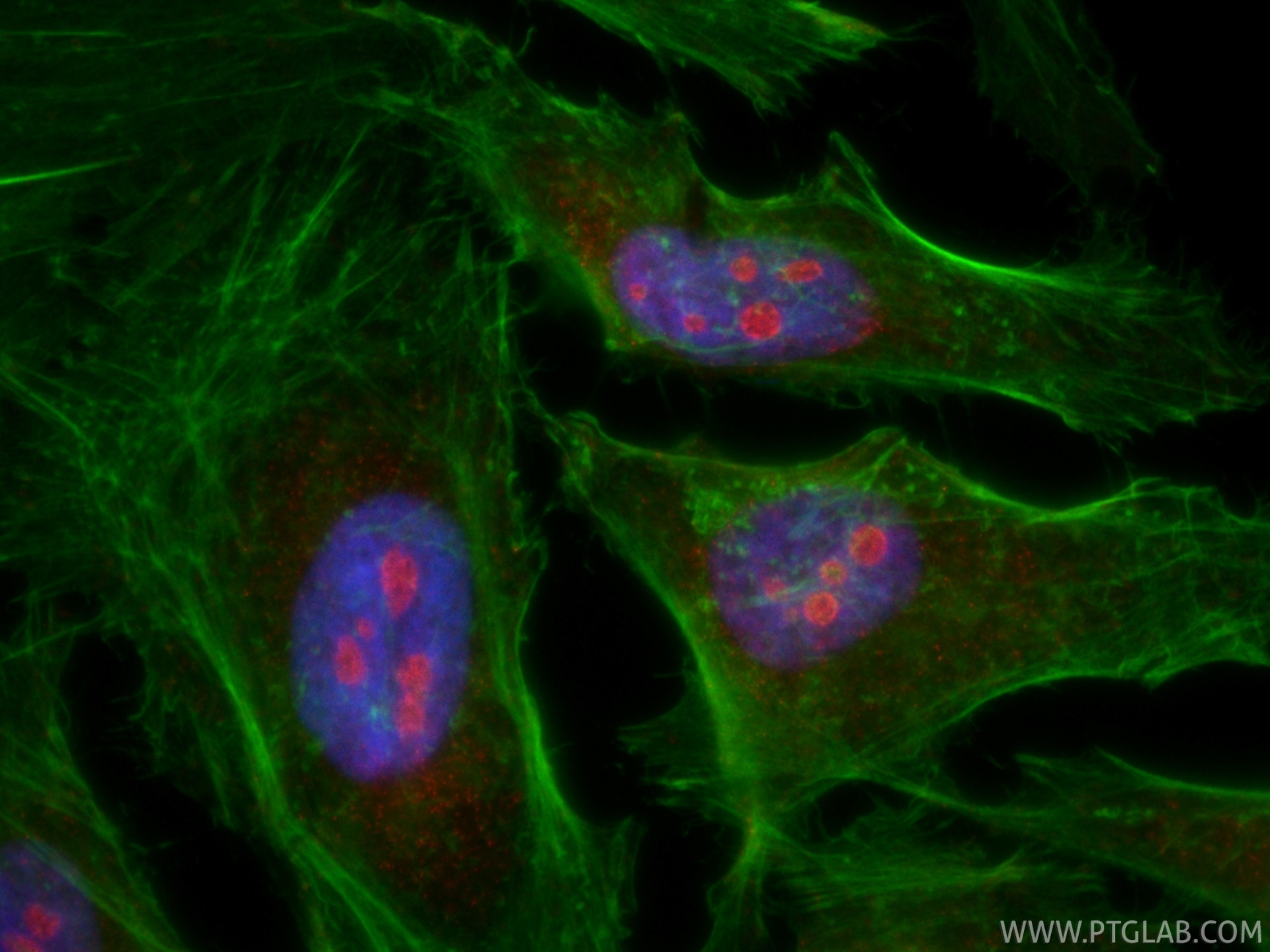 Immunofluorescence (IF) / fluorescent staining of HeLa cells using CoraLite®594-conjugated GNL3 Monoclonal antibody (CL594-67169)