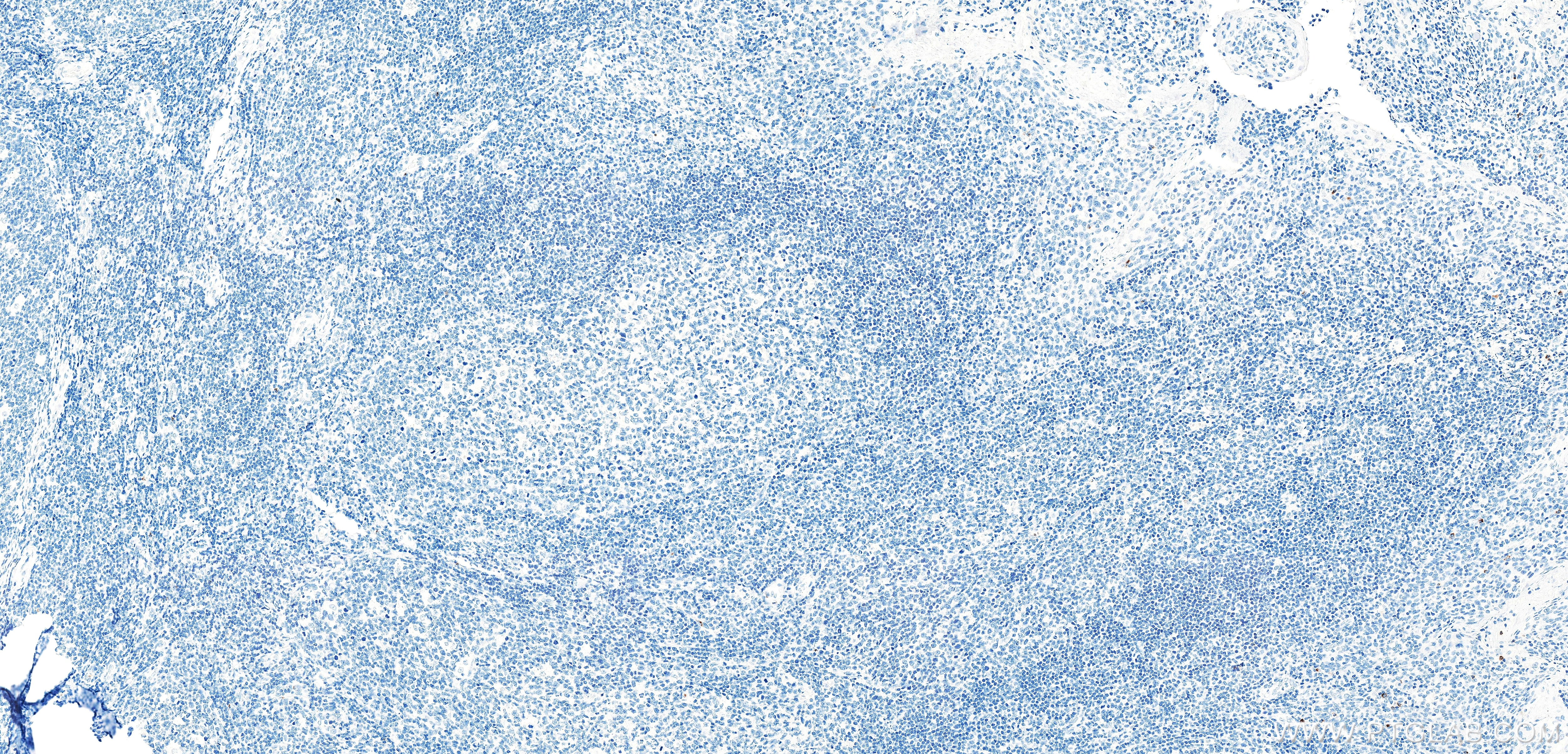 IHC staining of human tonsil using 87707-3-RR (same clone as 87707-3-PBS) Immunohistochemistry (IHC) staining of human tonsil tissue using GNLY/Granulysin Recombinant monoclonal antibody (87707-3-RR)