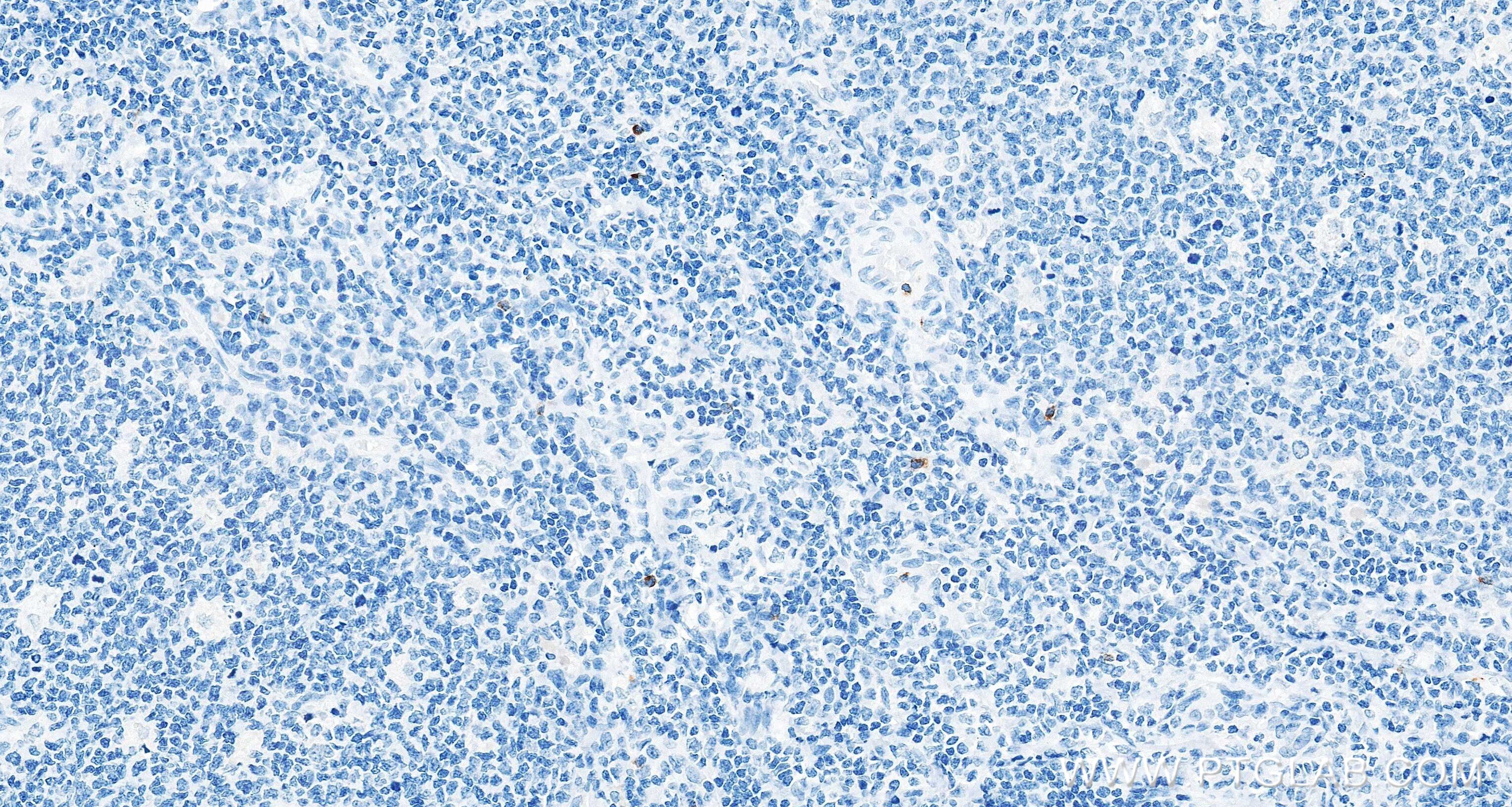 IHC staining of human tonsil using 87707-3-RR (same clone as 87707-3-PBS) Immunohistochemistry (IHC) staining of human tonsil tissue using GNLY/Granulysin Recombinant monoclonal antibody (87707-3-RR)