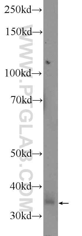 Western Blot (WB) analysis of mouse liver tissue using GNMT Polyclonal antibody (13495-1-AP)