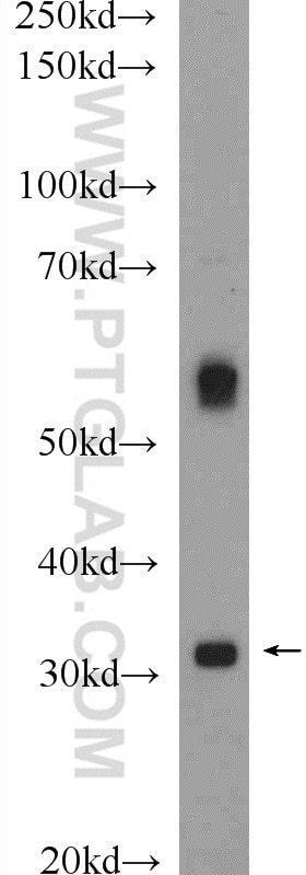 Western Blot (WB) analysis of rat liver tissue using GNMT Polyclonal antibody (13495-1-AP)