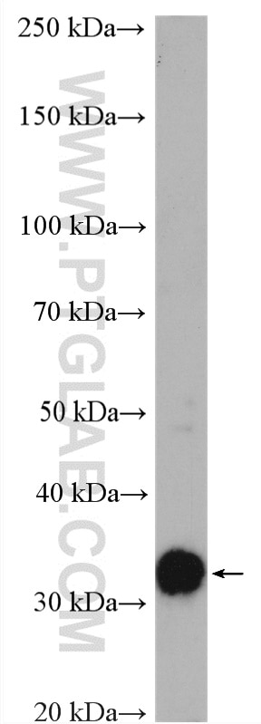 Western Blot (WB) analysis of rat liver tissue using GNMT Polyclonal antibody (18790-1-AP)