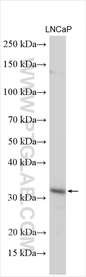 Western Blot (WB) analysis of various lysates using GNMT Polyclonal antibody (18790-1-AP)