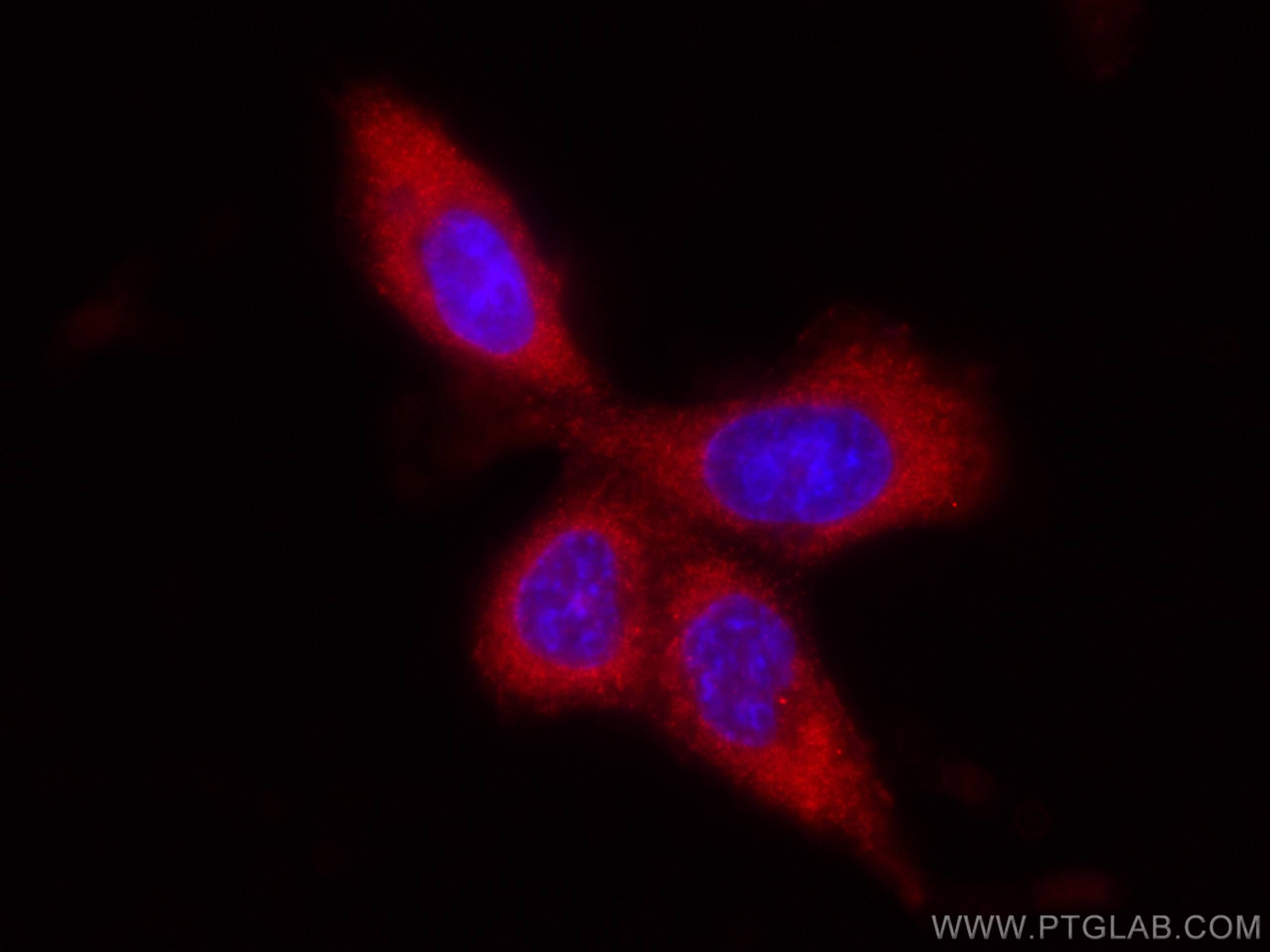 Immunofluorescence (IF) / fluorescent staining of A431 cells using GNMT Monoclonal antibody (67294-1-Ig)