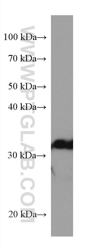 Western Blot (WB) analysis of rat liver tissue using GNMT Monoclonal antibody (67294-1-Ig)