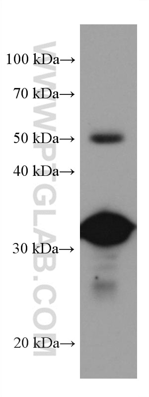 Western Blot (WB) analysis of mouse liver tissue using GNMT Monoclonal antibody (67294-1-Ig)