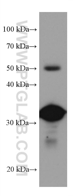 WB analysis of mouse liver using 67294-1-Ig