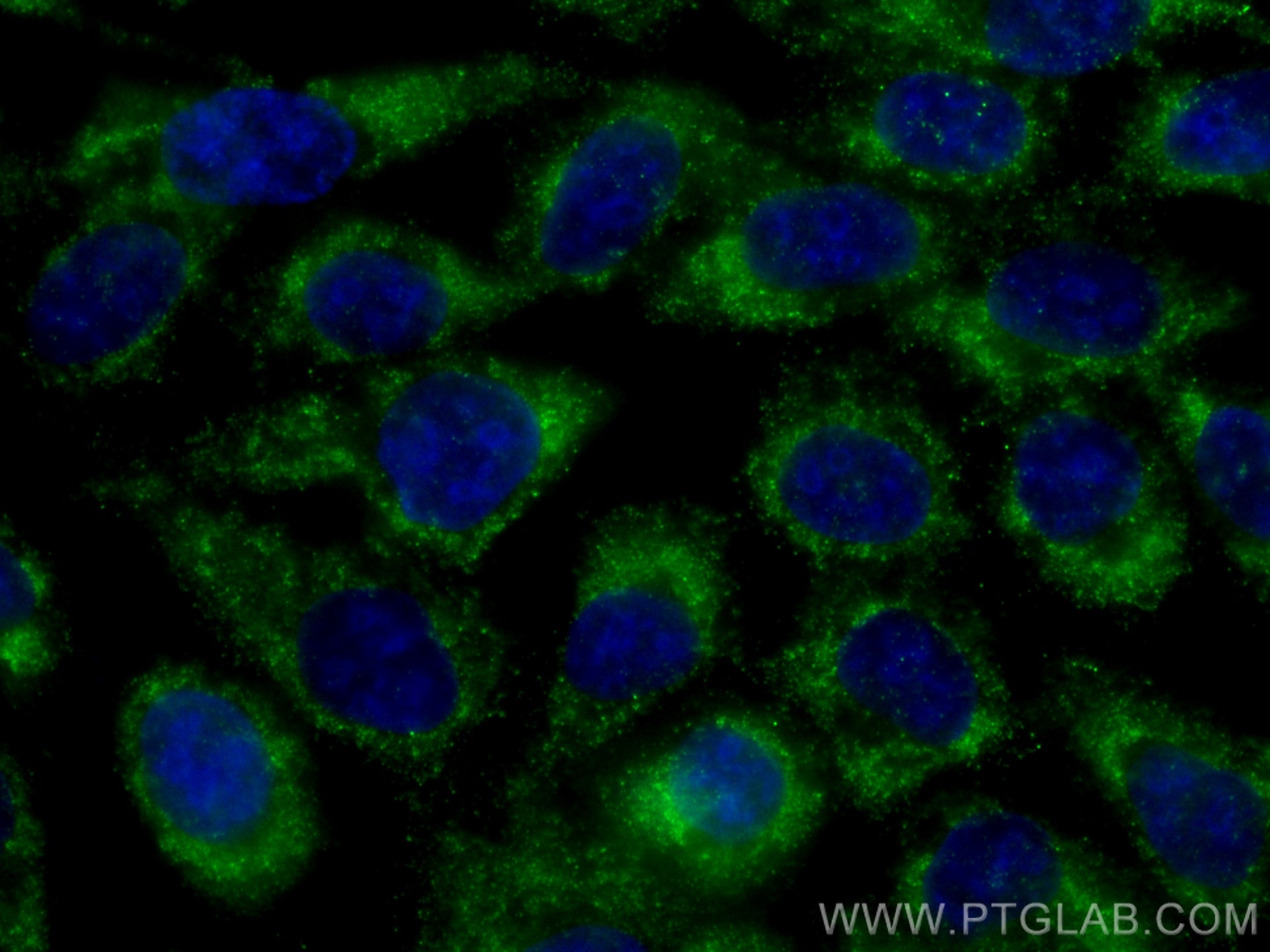 Immunofluorescence (IF) / fluorescent staining of A431 cells using CoraLite® Plus 488-conjugated GNMT Monoclonal anti (CL488-67294)