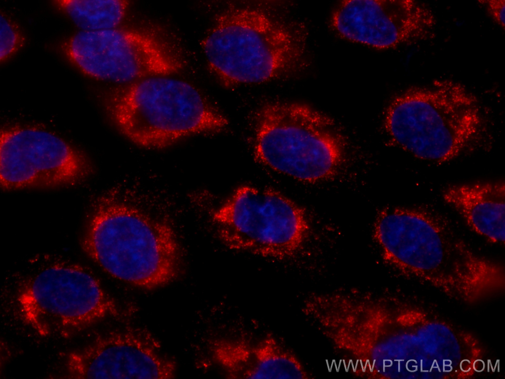 Immunofluorescence (IF) / fluorescent staining of A431 cells using CoraLite®594-conjugated GNMT Monoclonal antibody (CL594-67294)