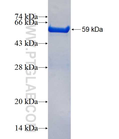 GNMT fusion protein Ag4321 SDS-PAGE